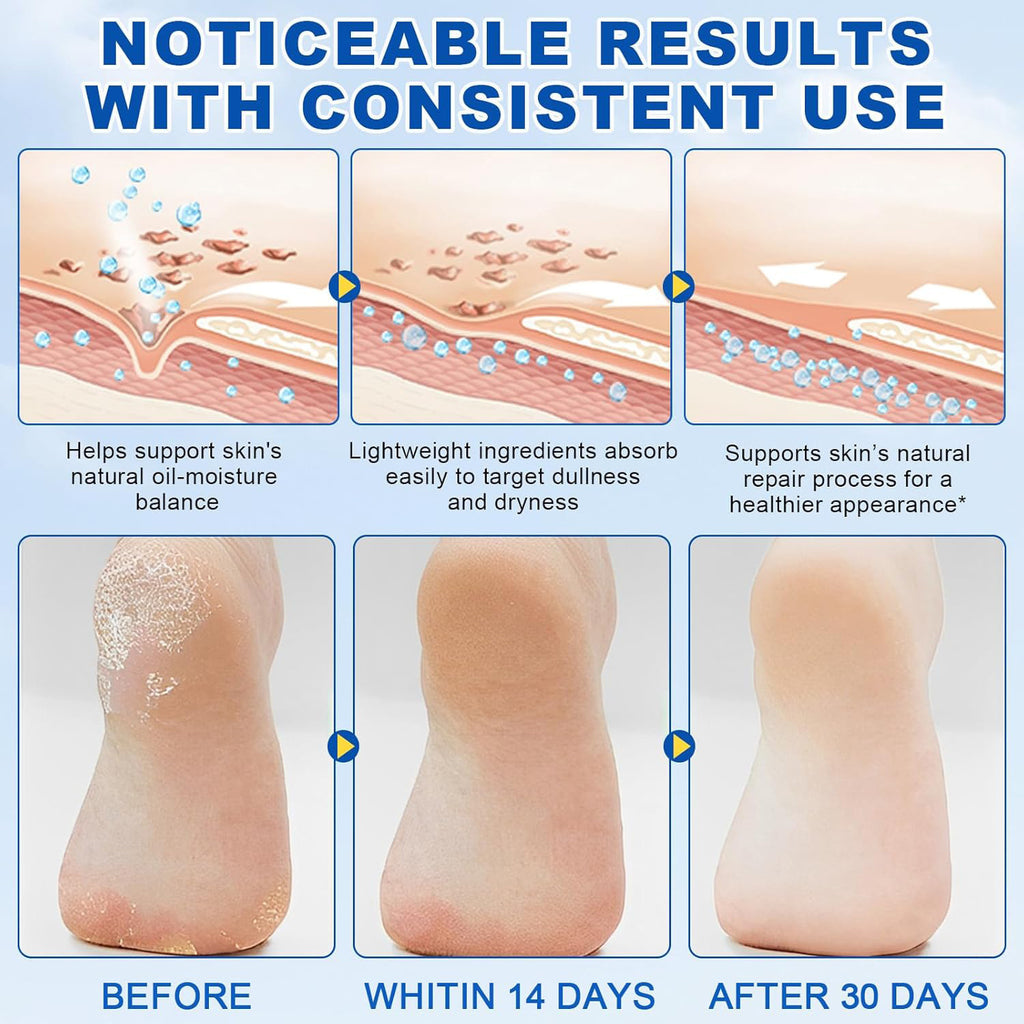 Gentle Hydrating Moisturizing Full-Body Care Urea Body Lotion