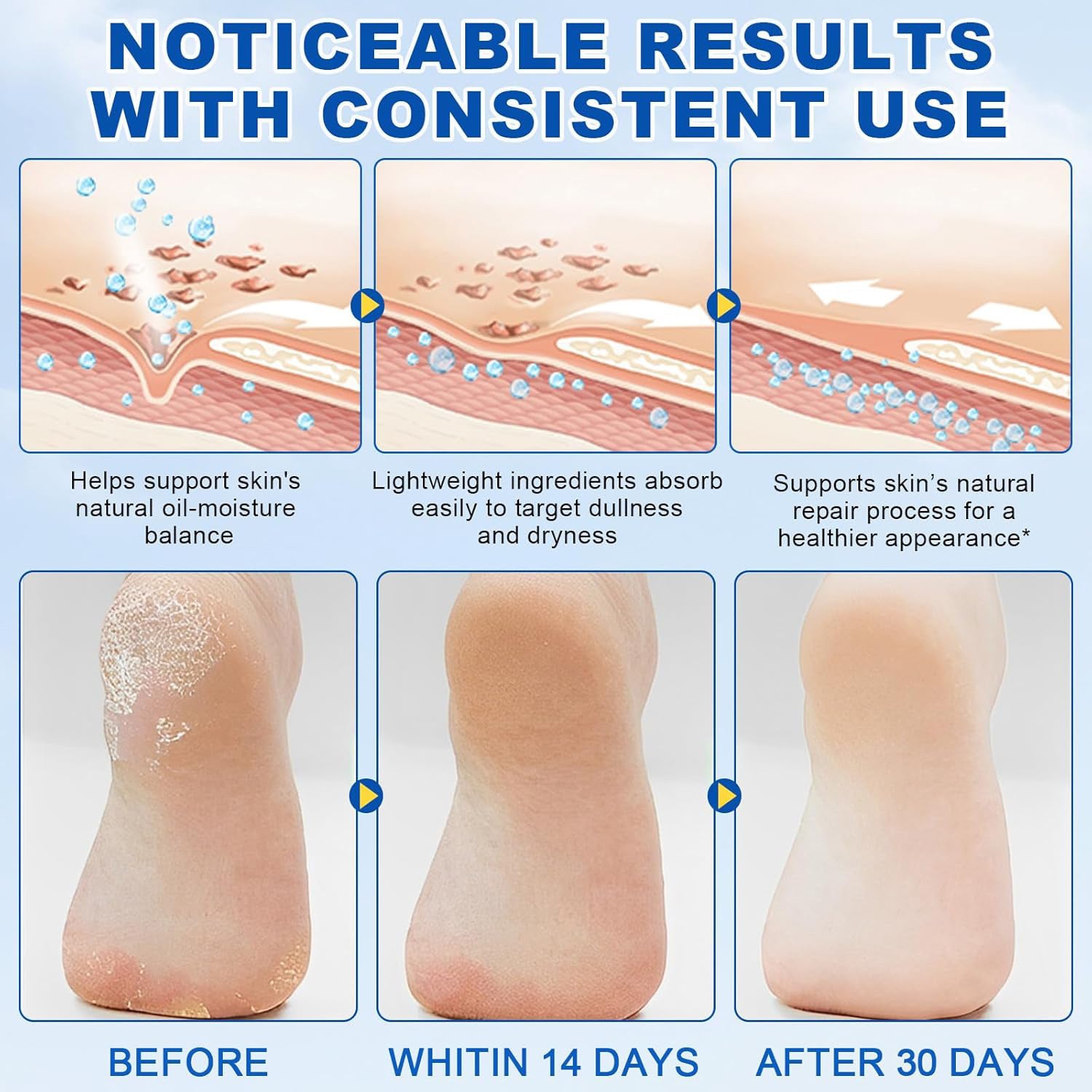 Gentle Hydrating Moisturizing Full-Body Care Urea Body Lotion